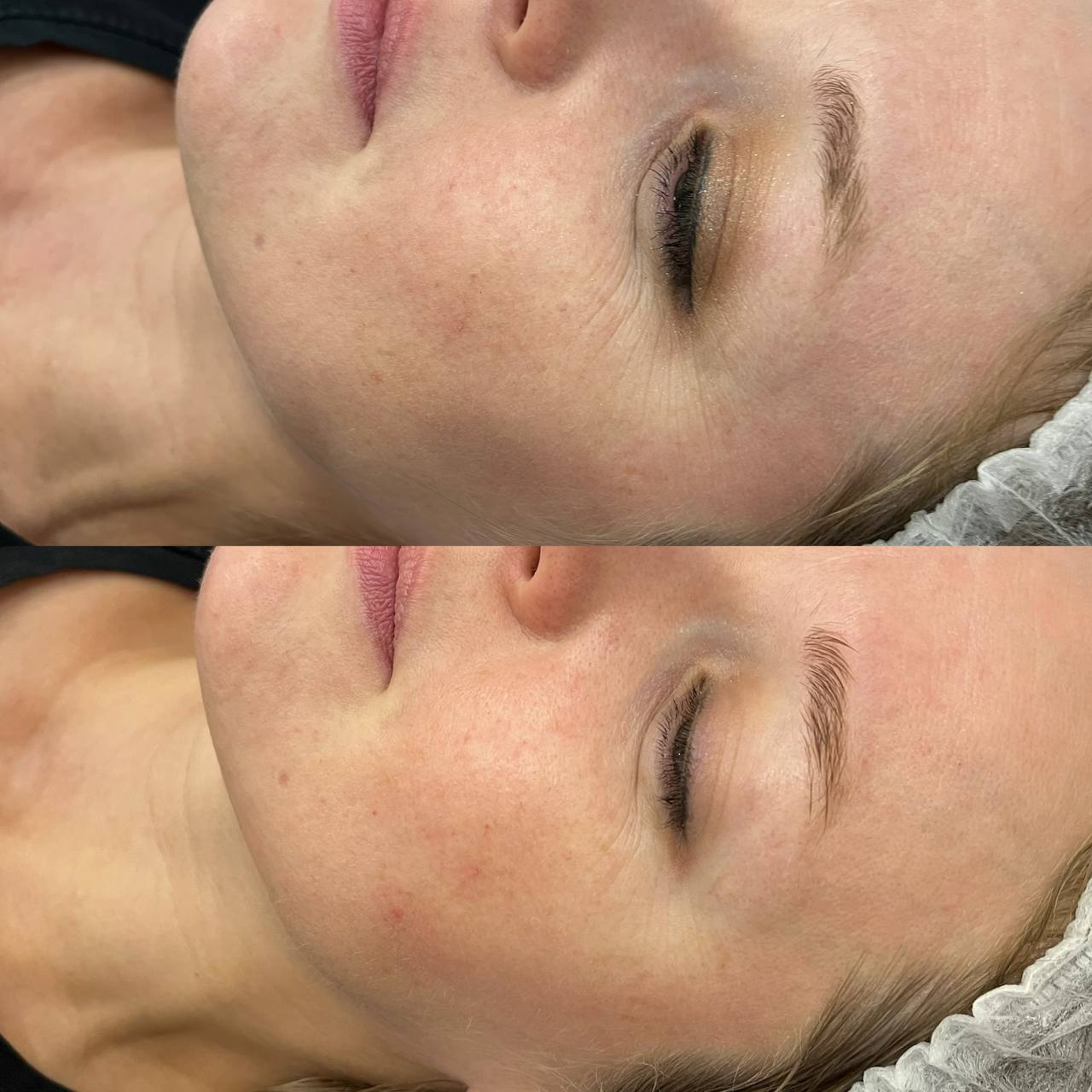ХИМИЧЕСКИЙ ПИЛИНГ С ГЛЮКОНОЛАКТОНОМ REFRESH PEEL ХИМИЧЕСКИЙ ПИЛИНГ С ГЛЮКОНОЛАКТОНОМ REFRESH PEEL