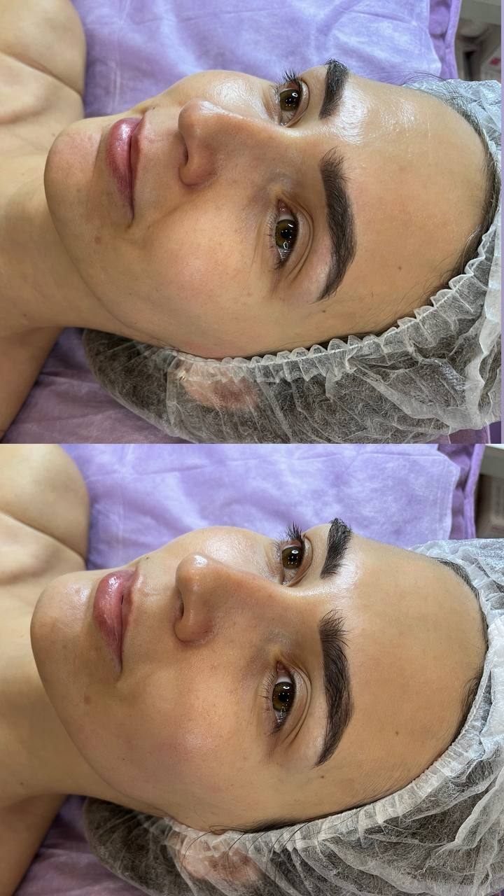 ХИМИЧЕСКИЙ ПИЛИНГ С ГЛЮКОНОЛАКТОНОМ REFRESH PEEL ХИМИЧЕСКИЙ ПИЛИНГ С ГЛЮКОНОЛАКТОНОМ REFRESH PEEL