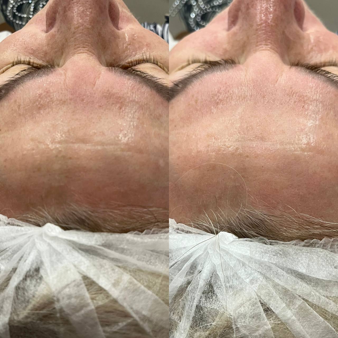 ХИМИЧЕСКИЙ ПИЛИНГ С ГЛЮКОНОЛАКТОНОМ REFRESH PEEL ХИМИЧЕСКИЙ ПИЛИНГ С ГЛЮКОНОЛАКТОНОМ REFRESH PEEL