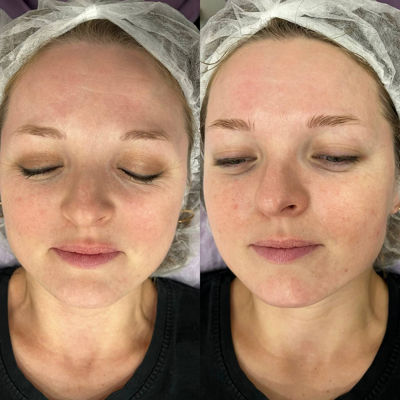 ХИМИЧЕСКИЙ ПИЛИНГ С ГЛЮКОНОЛАКТОНОМ REFRESH PEEL ХИМИЧЕСКИЙ ПИЛИНГ С ГЛЮКОНОЛАКТОНОМ REFRESH PEEL