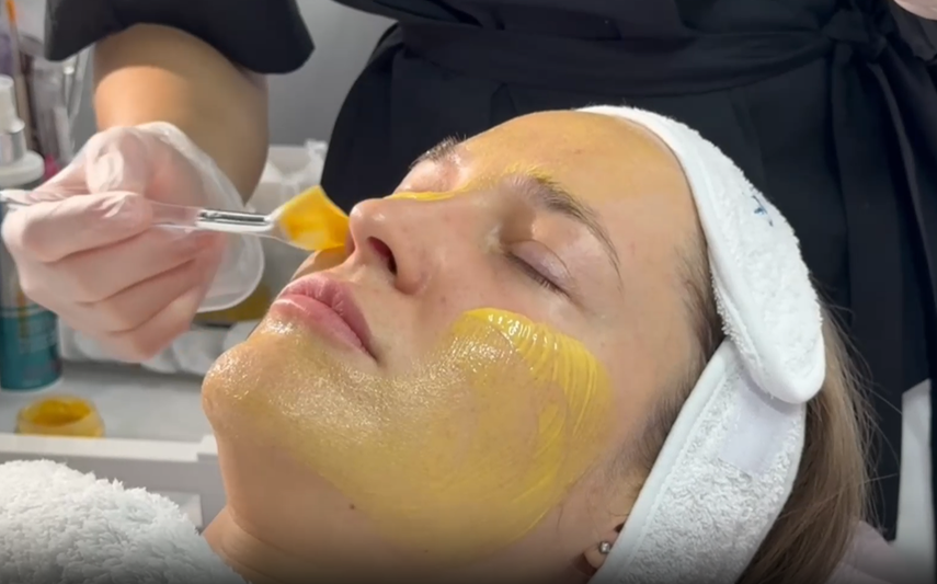 Желтый пилинг с ретиноевой кислотой ANTI-AGE PEEL