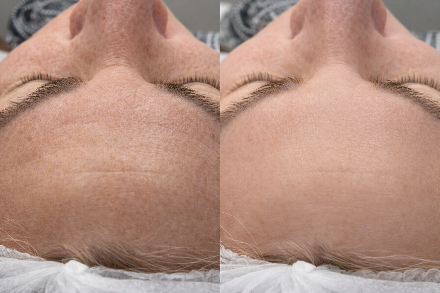 Гликолевый мультипилинг с молочной и салициловой кислотой MULTI PEEL