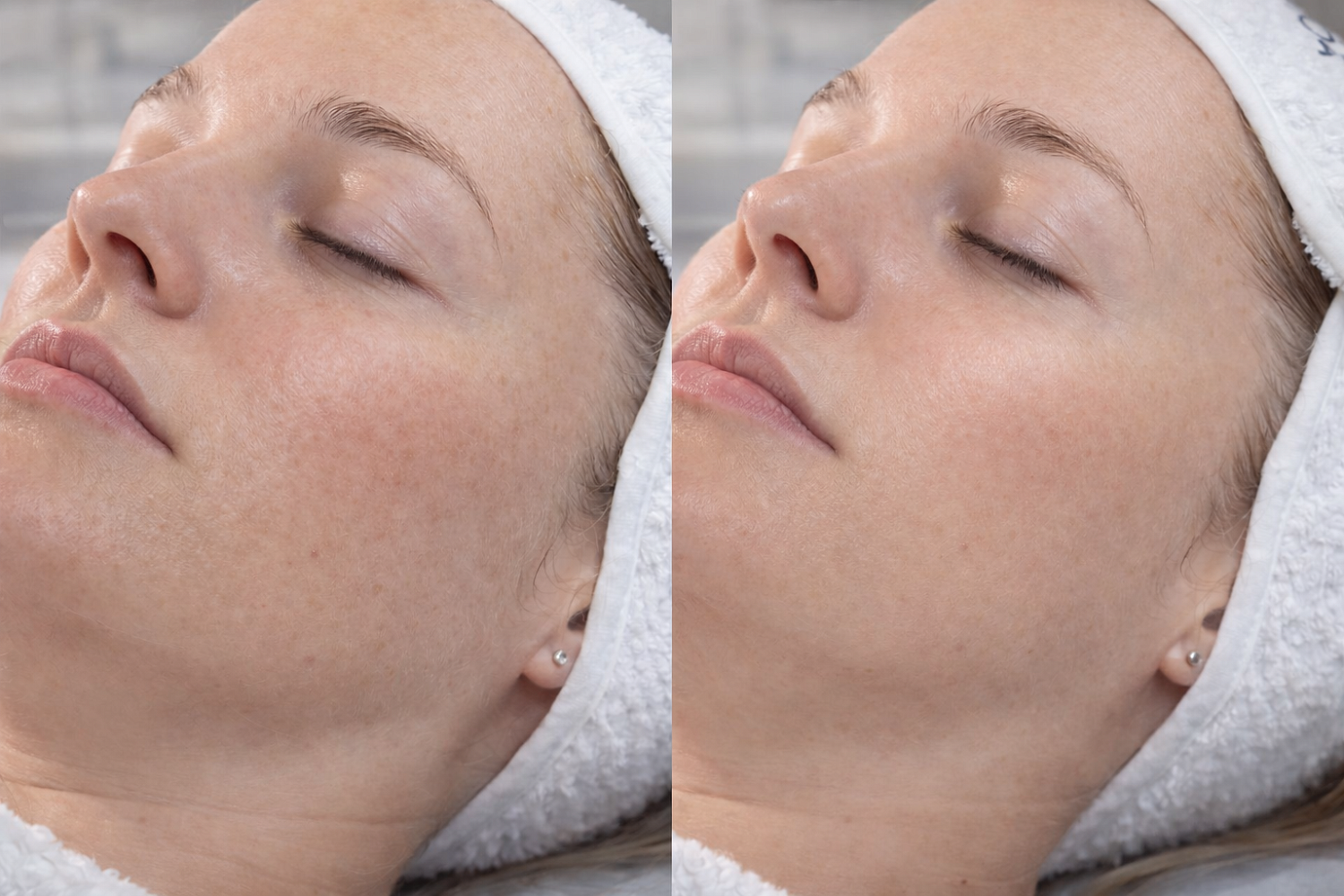 Гликолевый мультипилинг с молочной и салициловой кислотой MULTI PEEL